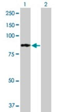 Anti-PFKL antibody produced in mouse purified immunoglobulin, buffered aqueous solution