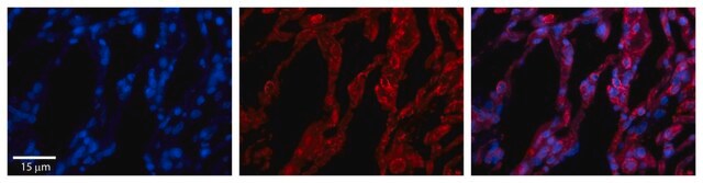 Anti-TAP1 antibody produced in rabbit affinity isolated antibody