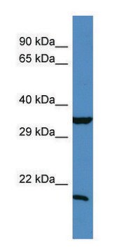 Anti-TIMP1 (N-terminal) antibody produced in rabbit affinity isolated antibody