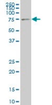 ANTI-LIMK1 antibody produced in mouse clone 3D10, purified immunoglobulin, buffered aqueous solution