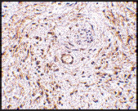 Anti-TEM5 antibody produced in rabbit affinity isolated antibody