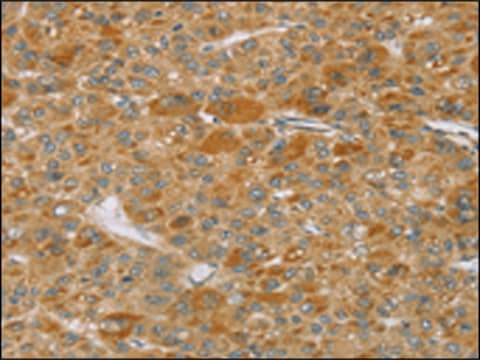 Anti-TP53I11 affinity isolated antibody