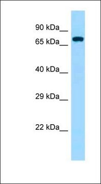 Anti-ZAP70 antibody produced in rabbit affinity isolated antibody