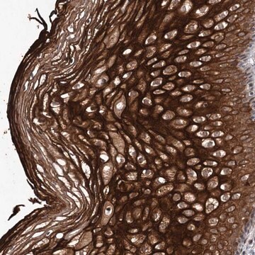 Anti-TTC31 antibody produced in rabbit Prestige Antibodies&#174; Powered by Atlas Antibodies, affinity isolated antibody, buffered aqueous glycerol solution