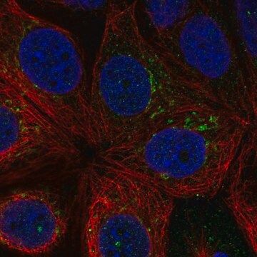 Anti-Rnf224 Antibody Produced In Rabbit Prestige Antibodies&#174; Powered by Atlas Antibodies, affinity isolated antibody, buffered aqueous glycerol solution