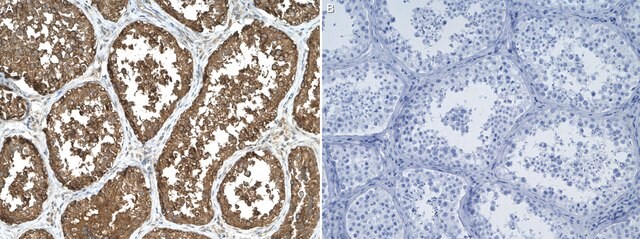 Anti-GATA4 Antibody, clone 1K15 ZooMAb&#174; Rabbit Monoclonal recombinant, expressed in HEK 293 cells