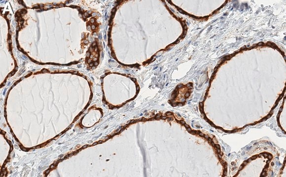 Anti-Cyclophilin B Antibody, clone 4D5 ZooMAb&#174; Rabbit Monoclonal recombinant, expressed in HEK 293 cells