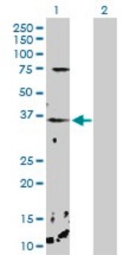 Anti-CHP antibody produced in rabbit purified immunoglobulin, buffered aqueous solution