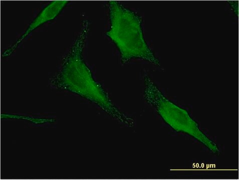 Monoclonal Anti-HEXA antibody produced in mouse clone 3D1, purified immunoglobulin, buffered aqueous solution