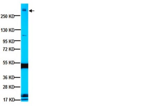 Anticuerpo anti-MAP2A, AP20 ascites fluid, clone AP20, Chemicon&#174;