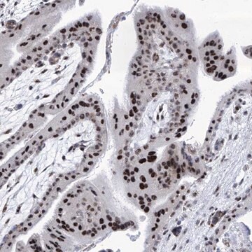 Anti-SART1 antibody produced in rabbit affinity isolated antibody, buffered aqueous glycerol solution, ab1