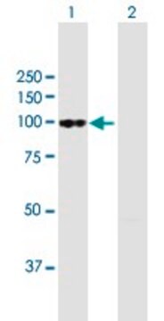 Anti-FAP antibody produced in mouse purified immunoglobulin, buffered aqueous solution