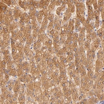 Anti-CBS antibody produced in rabbit Prestige Antibodies&#174; Powered by Atlas Antibodies, affinity isolated antibody, buffered aqueous glycerol solution