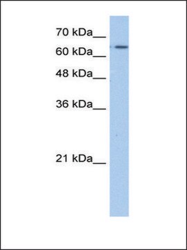 Anti-SLC22A11 antibody produced in rabbit IgG fraction of antiserum