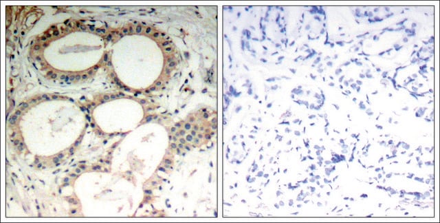 Anti-NFKBIE (Ab-22) antibody produced in rabbit affinity isolated antibody