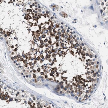 Anti-PRTFDC1 antibody produced in rabbit Prestige Antibodies&#174; Powered by Atlas Antibodies, affinity isolated antibody, buffered aqueous glycerol solution