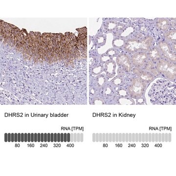 Anti-DHRS2 antibody produced in rabbit Prestige Antibodies&#174; Powered by Atlas Antibodies, affinity isolated antibody, buffered aqueous glycerol solution