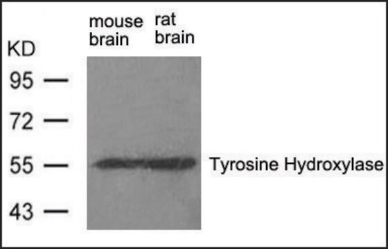 Anti-Th (Ab-31) antibody produced in rabbit affinity isolated antibody