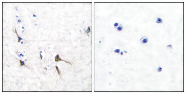 Anti-Potassium Channel Kv3.2b antibody produced in rabbit affinity isolated antibody