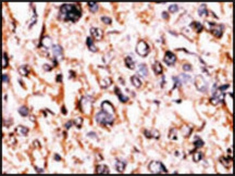 Anti-MARK4 (N-term) antibody produced in rabbit IgG fraction of antiserum, buffered aqueous solution