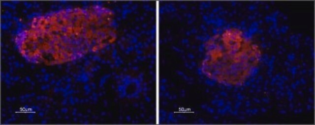 抗P2X7 嘌呤能受体 兔抗 affinity isolated antibody, lyophilized powder