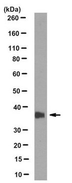 Anti-HSD17B3 Antibody, clone 3E11.2 clone 3E11.2, from mouse