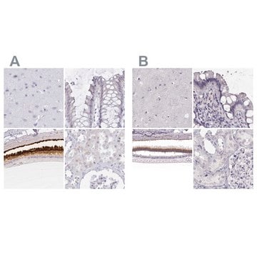 Anti-IMPG1 antibody produced in rabbit Prestige Antibodies&#174; Powered by Atlas Antibodies, affinity isolated antibody