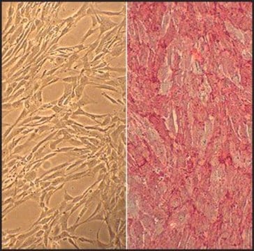 Glatte Muskelzellen des menschlichen Truncus brachiocephalicus: HBcASMC, Erwachsener