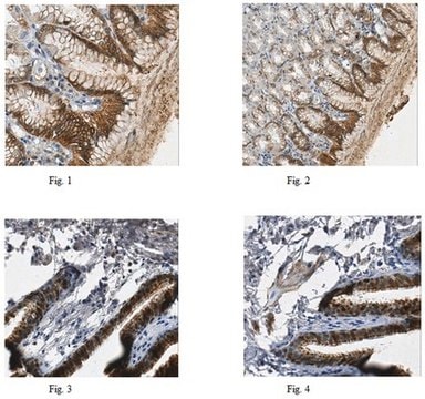 Anti-ALDH3A1, clone 10C7.1 Antibody clone 10C7.1, from mouse