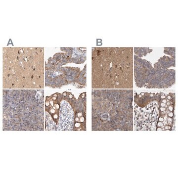 Anti-TSPOAP1 antibody produced in rabbit Prestige Antibodies&#174; Powered by Atlas Antibodies, affinity isolated antibody, buffered aqueous glycerol solution, Ab1