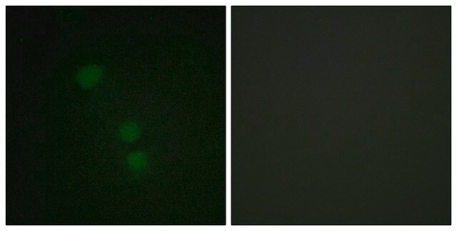 Anti-Histone H2B (Acetyl-Lys15) antibody produced in rabbit affinity isolated antibody