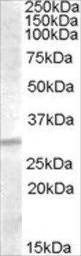 Anti-IGFBP4 antibody produced in goat affinity isolated antibody, buffered aqueous solution