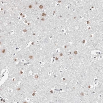 Anti-ORC1 antibody produced in rabbit Prestige Antibodies&#174; Powered by Atlas Antibodies, affinity isolated antibody, buffered aqueous glycerol solution