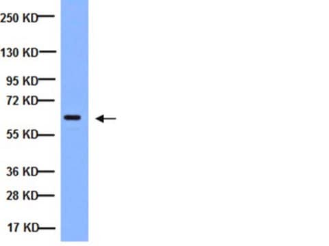 Anticorpo antiNF&#954;B, subunidade p65, subunidade ativa, clone 12H11 clone 12H11, Chemicon&#174;, from mouse