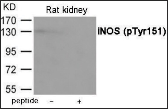 Anti-phospho-iNOS (pTyr151) antibody produced in rabbit affinity isolated antibody