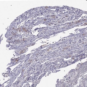 Anti-MYO15A antibody produced in rabbit Prestige Antibodies&#174; Powered by Atlas Antibodies, affinity isolated antibody