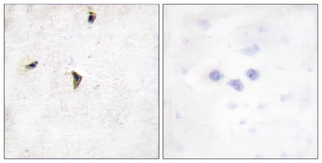 Anti-KV2.1 antibody produced in rabbit affinity isolated antibody