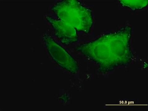 Anti-ECH1 antibody produced in mouse purified immunoglobulin, buffered aqueous solution