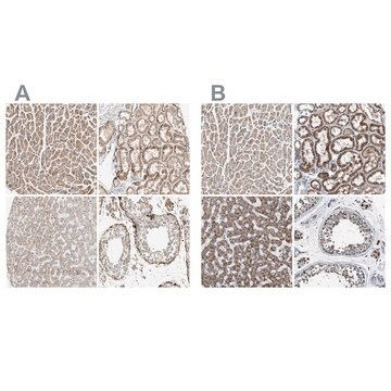 Anti-OXSM antibody produced in rabbit Prestige Antibodies&#174; Powered by Atlas Antibodies, affinity isolated antibody, buffered aqueous glycerol solution, Ab2