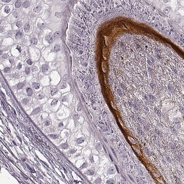 Anti-KRTAP16-1 antibody produced in rabbit Prestige Antibodies&#174; Powered by Atlas Antibodies, affinity isolated antibody