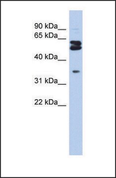 Anti-OGFOD1 antibody produced in rabbit affinity isolated antibody