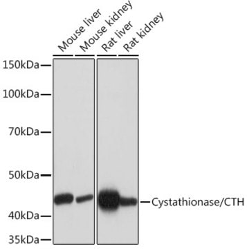 Anti-Cystathionase/CTH Antibody, clone 7L3D0, Rabbit Monoclonal