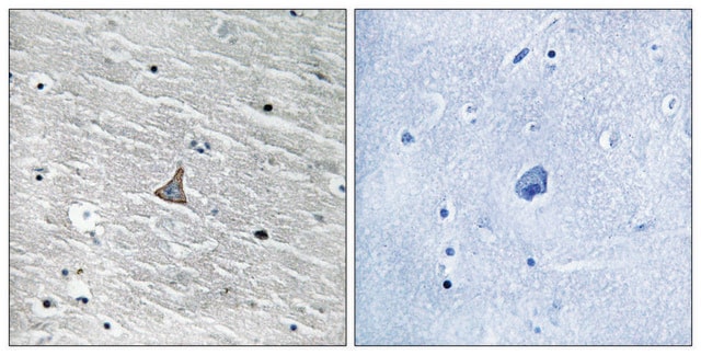 Anti-VHL antibody produced in rabbit affinity isolated antibody