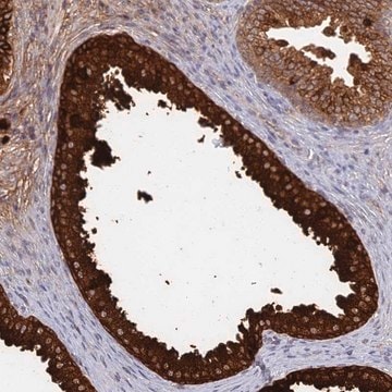 Anti-GPATCH1 antibody produced in rabbit Prestige Antibodies&#174; Powered by Atlas Antibodies, affinity isolated antibody, buffered aqueous glycerol solution