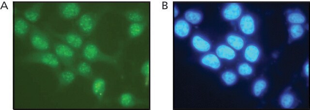 Anti-RAD17 (C-terminal) antibody produced in rabbit ~1&#160;mg/mL, affinity isolated antibody, buffered aqueous solution