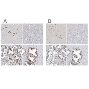 Anti-WRNIP1 antibody produced in rabbit Prestige Antibodies&#174; Powered by Atlas Antibodies, affinity isolated antibody, buffered aqueous glycerol solution