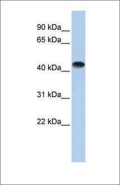 Anti-CKM (ab2) antibody produced in rabbit affinity isolated antibody