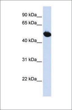 SLC2A9 Antibody Western SAB2102201