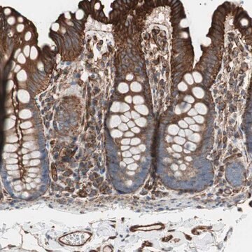 Anti-TCTA antibody produced in rabbit Prestige Antibodies&#174; Powered by Atlas Antibodies, affinity isolated antibody, buffered aqueous glycerol solution