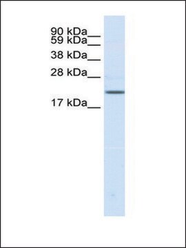 Anti-SCN3B affinity isolated antibody